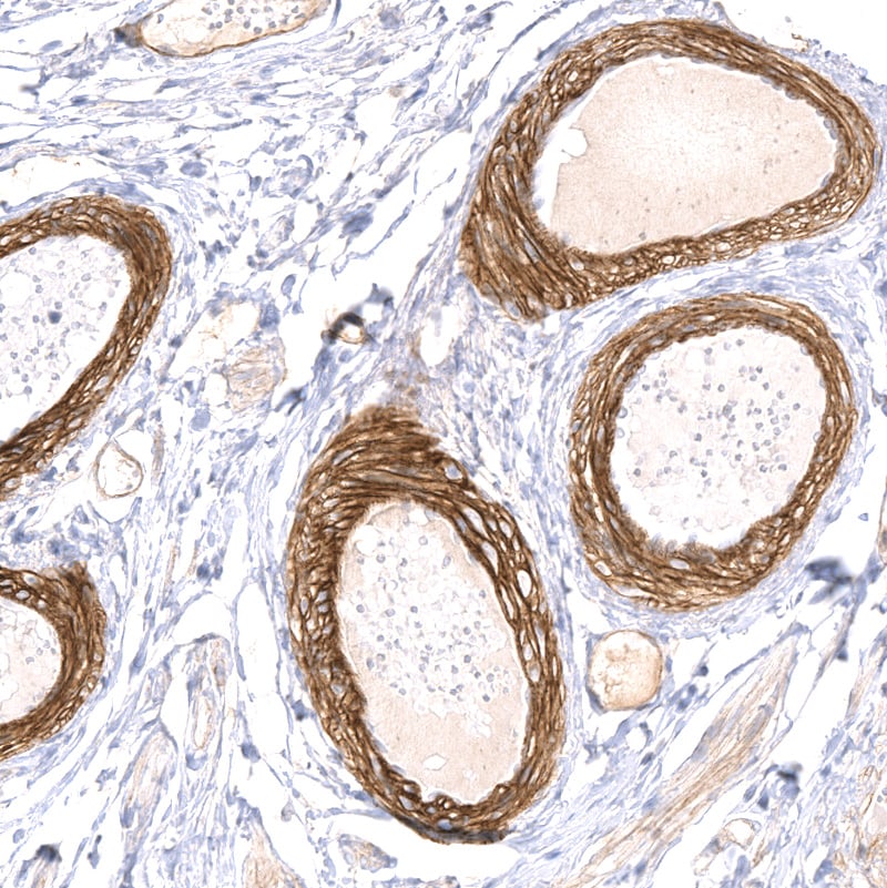 Laminin alpha 5 Antibody (CL3118) - BSA Free