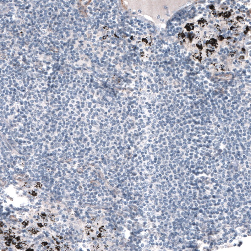 Laminin alpha 5 Antibody (CL3118) - BSA Free