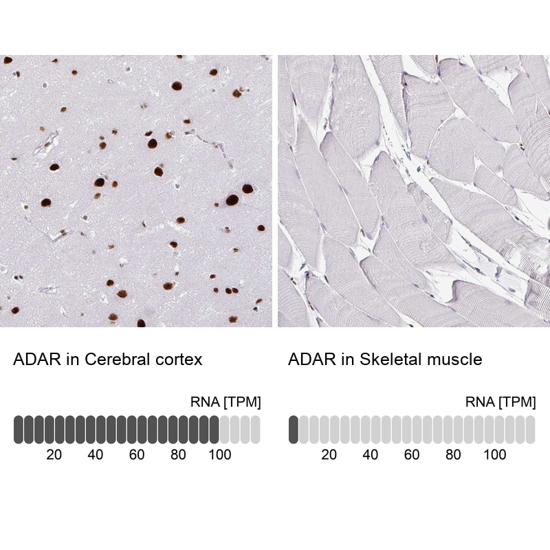 ADAR Antibody (CL0176) - BSA Free
