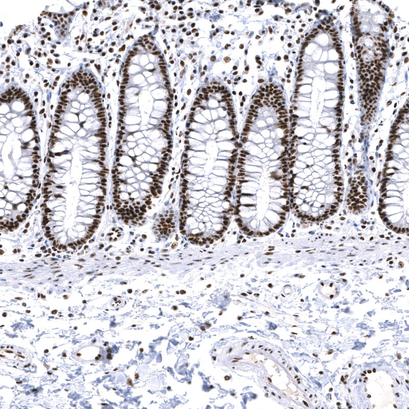 ADAR Antibody (CL0176) - BSA Free