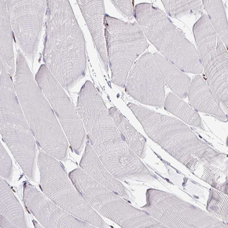 ADAR Antibody (CL0176) - BSA Free