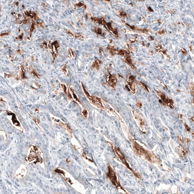 MUC5AC Antibody (CL8961) - BSA Free