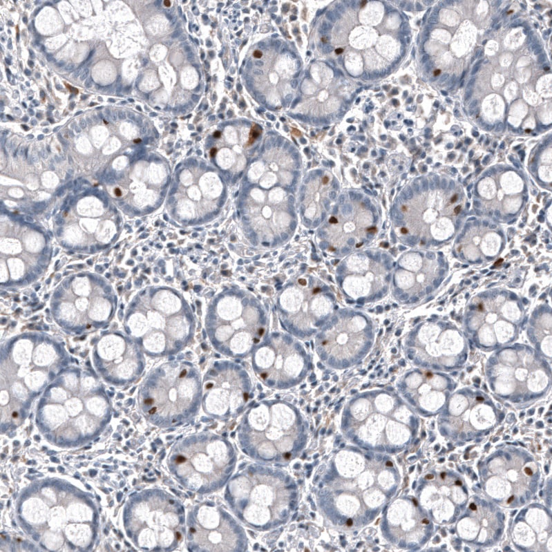INSM1 Antibody (CL11630) - BSA Free