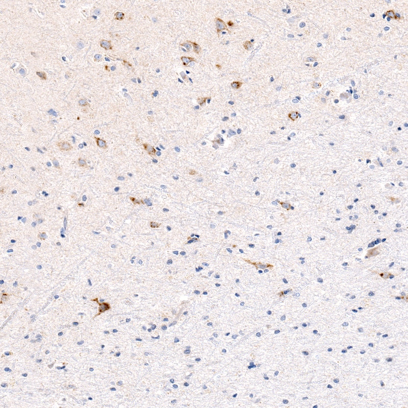 CTGF/CCN2 Antibody (CL5339) - BSA Free
