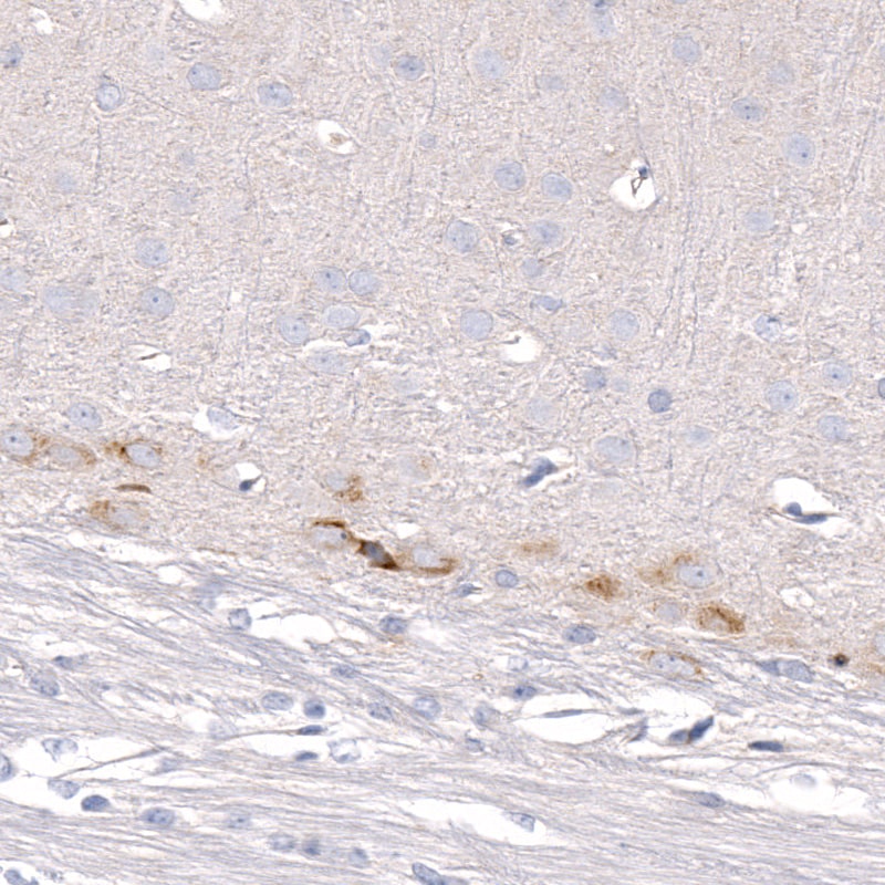 CTGF/CCN2 Antibody (CL5339) - BSA Free