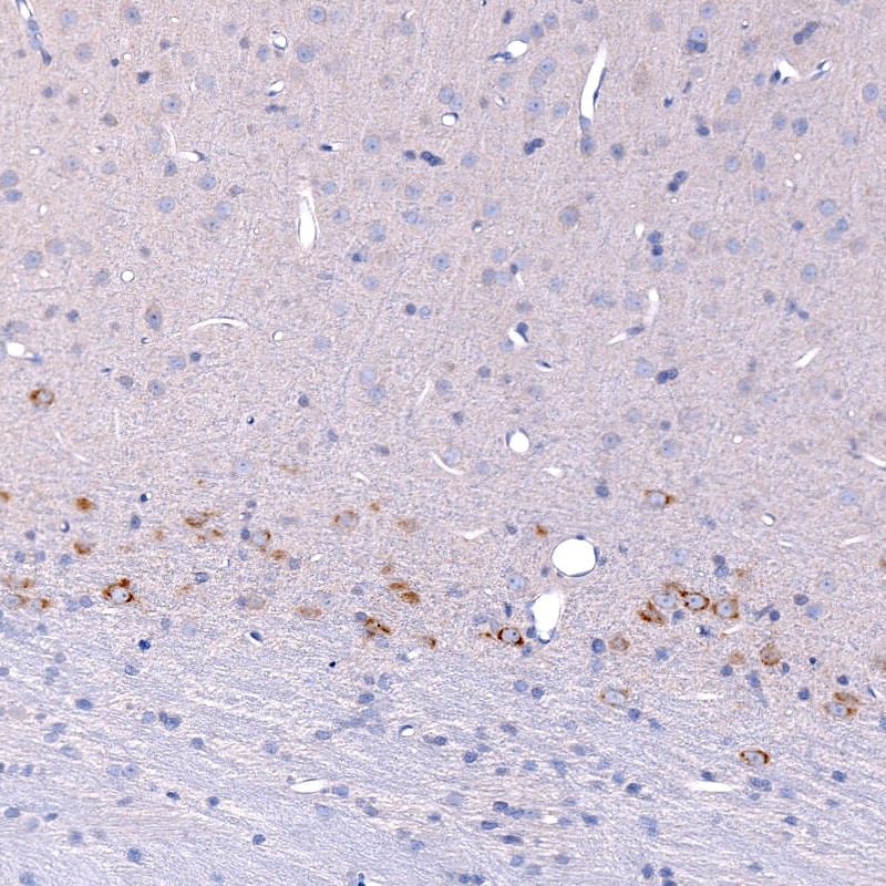 CTGF/CCN2 Antibody (CL5339) - BSA Free