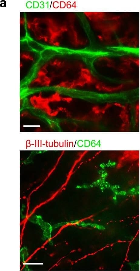Detection of Mouse beta-III Tubulin by Immunocytochemistry/Immunofluorescence