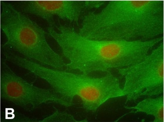 PTGFR Antibody - BSA Free