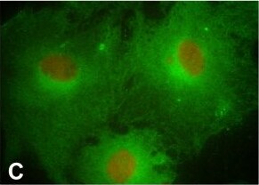PTGFR Antibody - BSA Free