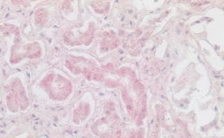 CXCR6 Antibody - BSA Free