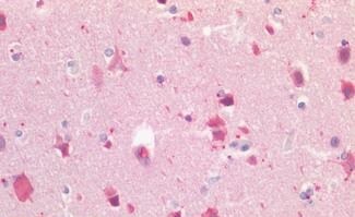 Lgr5/GPR49 Antibody - BSA Free