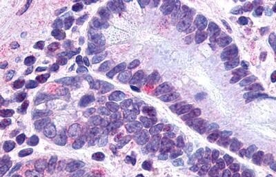 GLP-2R Antibody - BSA Free