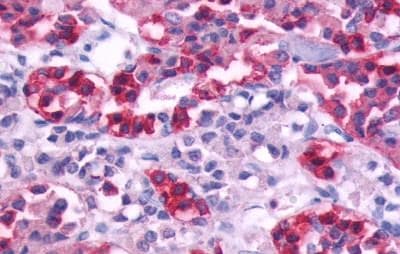 Muscarinic Acetylcholine Receptor M5/CHRM5 Antibody - BSA Free