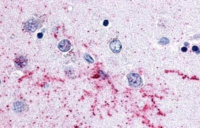 MCHR2 Antibody - BSA Free