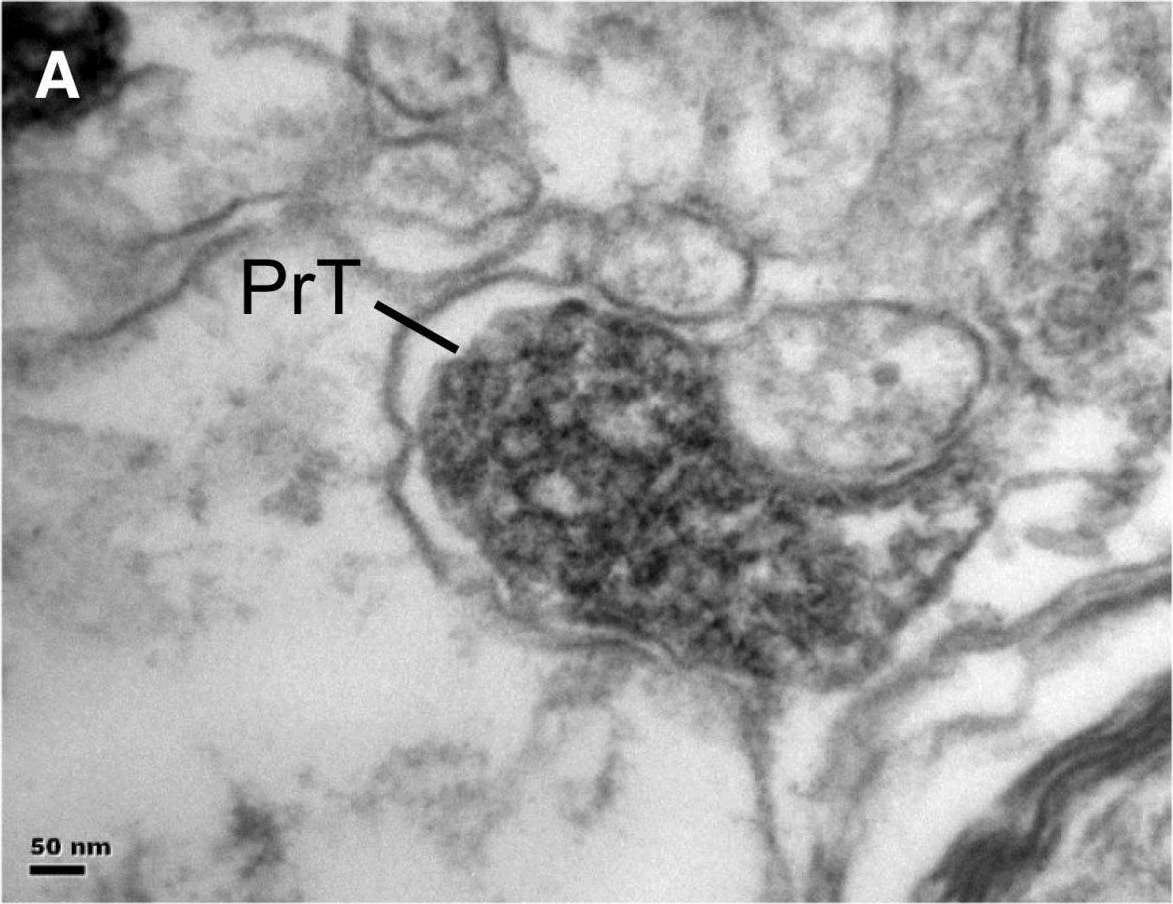 FPRL1/FPR2 Antibody - BSA Free