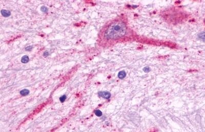 MCHR2 Antibody - BSA Free