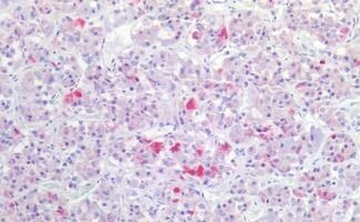 GnRHR Antibody - BSA Free