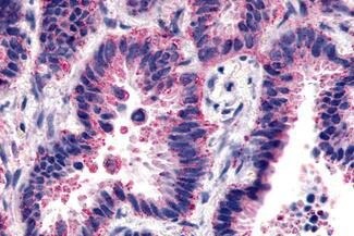 Frizzled-2 Antibody - BSA Free
