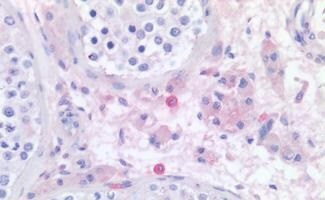 Histamine H4R Antibody - BSA Free