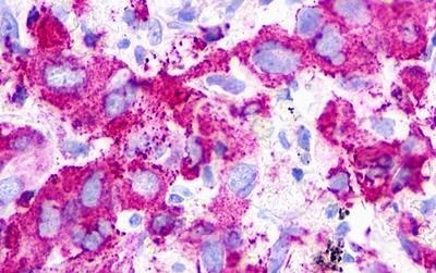 P2Y1/P2RY1 Antibody - BSA Free