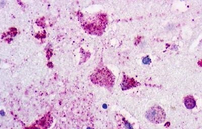 P2Y1/P2RY1 Antibody - BSA Free