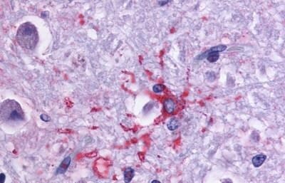 Dopamine D1R/DRD1 Antibody - BSA Free
