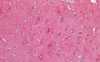 CRLR Antibody - BSA Free