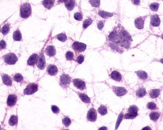 mGluR3 Antibody - BSA Free