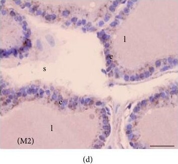 Melatonin Receptor 1B Antibody - BSA Free