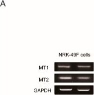 Melatonin Receptor 1B Antibody - BSA Free