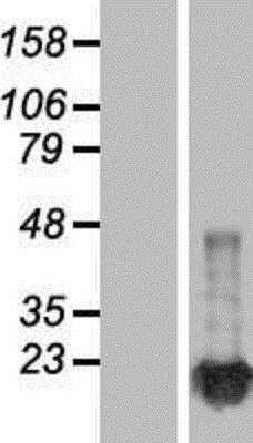 Western Blot: NM23-H1 Overexpression Lysate [NBP2-04713]