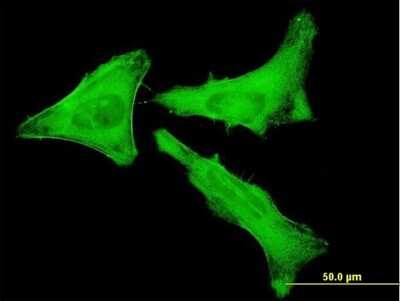 Immunocytochemistry/ Immunofluorescence: non-muscle Myosin IIA Antibody (2B3) [H00004627-M03]