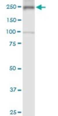 Western Blot: non-muscle Myosin IIA Antibody (2B3) [H00004627-M03]