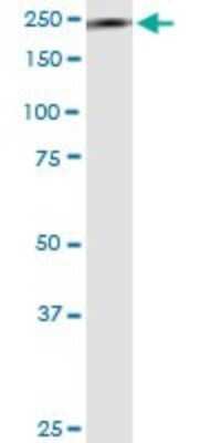 Western Blot: non-muscle Myosin IIA Antibody (2B3) [H00004627-M03]