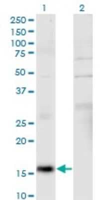 Western Blot: non-muscle Myosin IIA Antibody (2B3) [H00004627-M03]