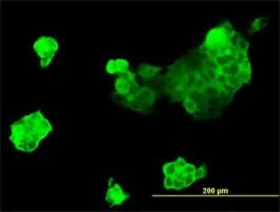 Immunocytochemistry/ Immunofluorescence: non-muscle Myosin IIA Antibody (3C7) [H00004627-M01]