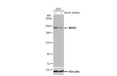 Western Blot: non-muscle Myosin IIA Antibody (GT218) [NBP3-13532]