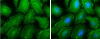 Immunocytochemistry/ Immunofluorescence: non-muscle Myosin IIA Antibody [NBP1-31733]