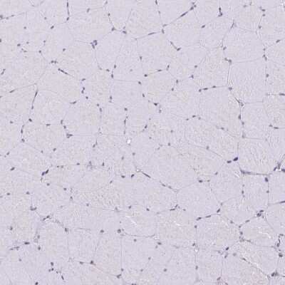 Immunohistochemistry-Paraffin: non-muscle heavy chain 10 Myosin Antibody [NBP2-38566]