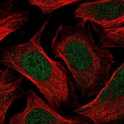 Immunocytochemistry/ Immunofluorescence: p107 Antibody [NBP2-33791]