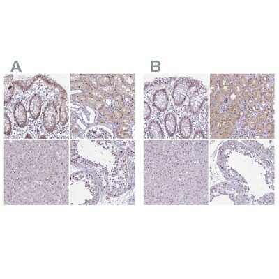 Immunohistochemistry-Paraffin: p107 Antibody [NBP2-33735]