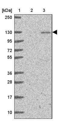 Western Blot: p107 Antibody [NBP2-33735]