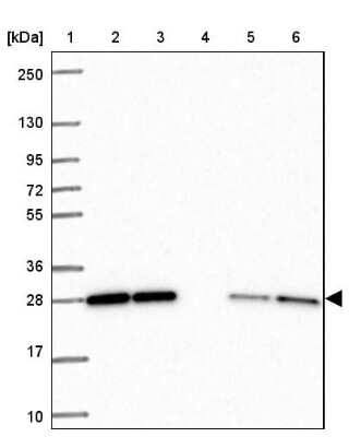 Western Blot: p107 Antibody [NBP2-33791]