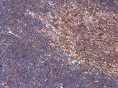 Immunohistochemistry-Paraffin: p114RhoGEF Antibody [NBP1-32816]