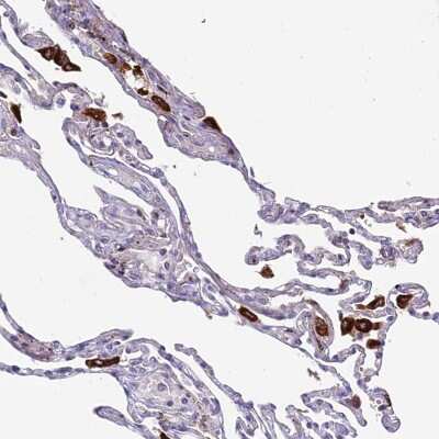 Immunohistochemistry-Paraffin: p114RhoGEF Antibody [NBP1-92238]