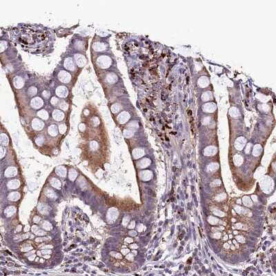 Immunohistochemistry-Paraffin: p114RhoGEF Antibody [NBP1-92238]
