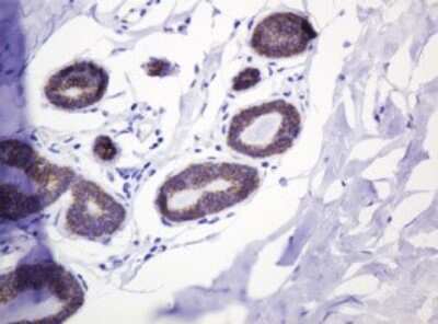 Immunohistochemistry: p120-catenin Antibody (OTI2E8) [NBP2-45646]