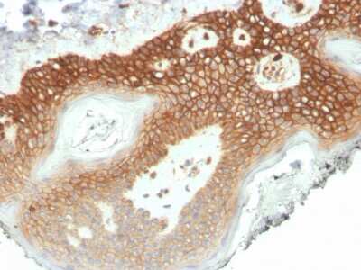Immunohistochemistry-Paraffin: p120-catenin Antibody (CTNND1/4501) [NBP3-07801]
