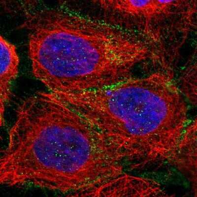 Immunocytochemistry/ Immunofluorescence: p120-catenin Antibody [NBP1-85383]