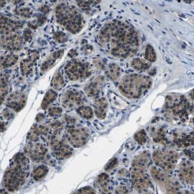 Immunohistochemistry-Paraffin: p120-catenin Antibody [NBP2-38130]